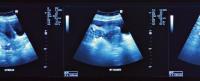 Ultrasound images displaying the uterus